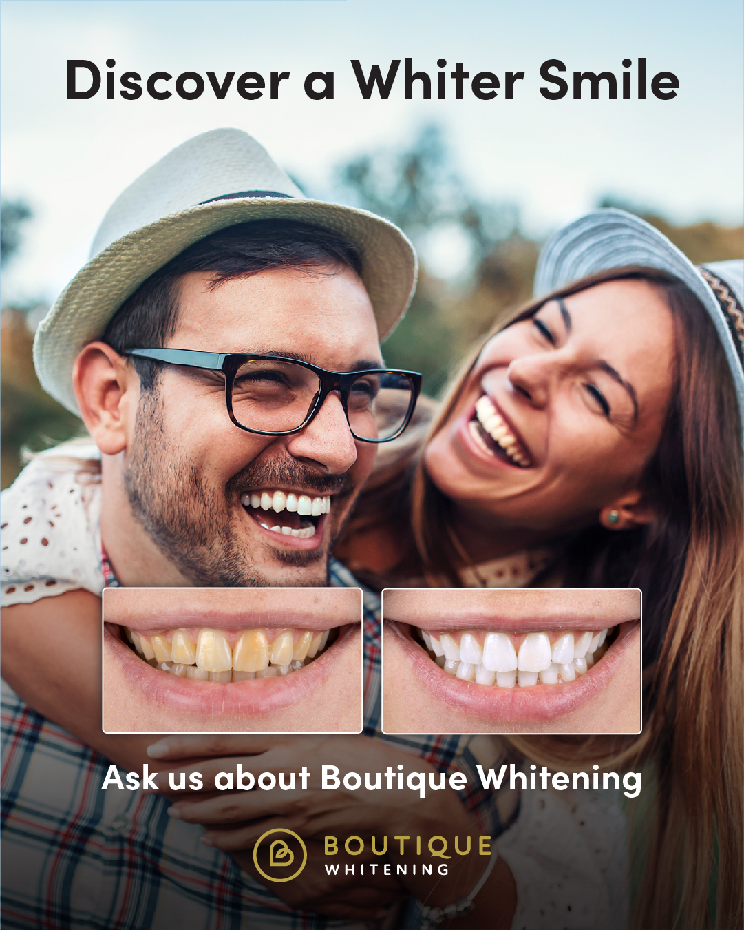 Before and after Boutique teeth whitening results